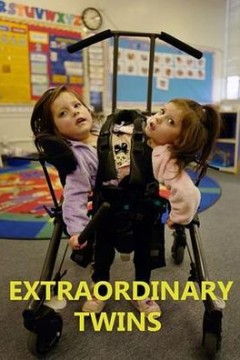 连体双胞胎第一季