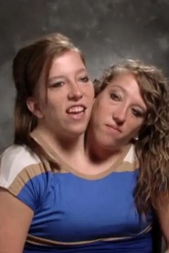 连体姐妹花：艾比和布列塔尼